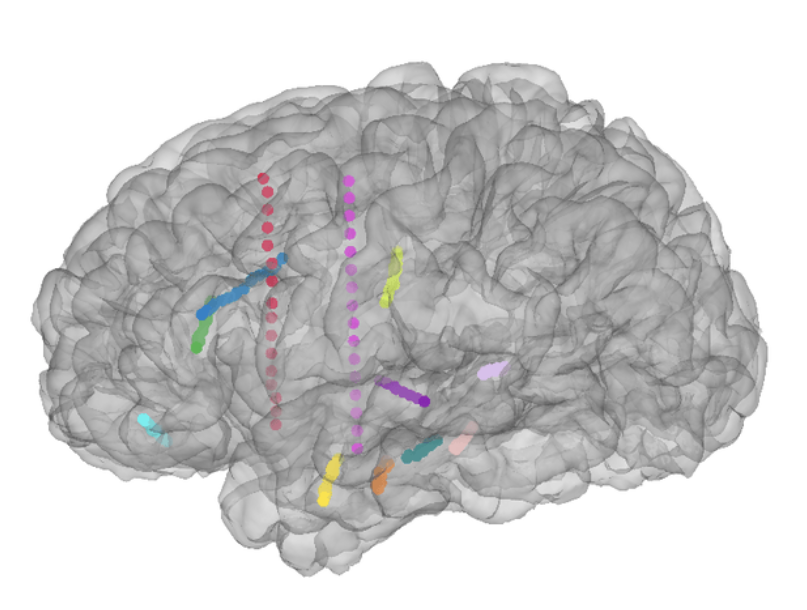 Cogan Lab sEEG speech perception analysis